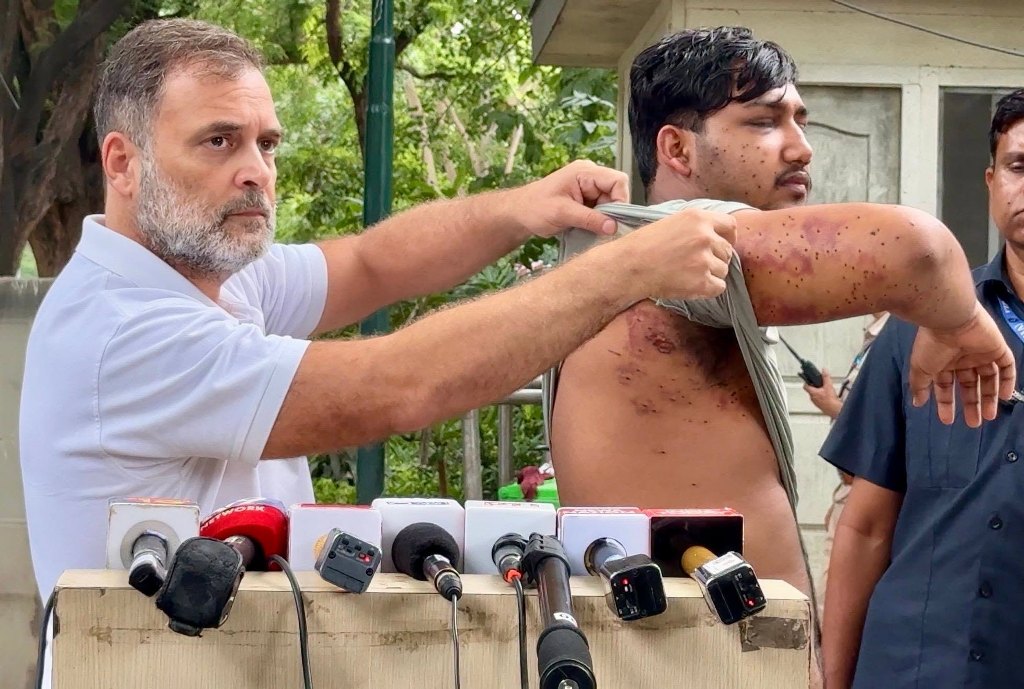 পেলেট গানে আহত পড়ুয়াকে সামনে এনে সরকারের বিরুদ্ধে তোপ রাহুলের 