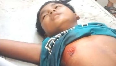 গুলিবিদ্ধ হয়ে আহত কিশোর 