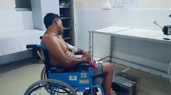 ট্রান্সফরমারে কাজ করতে গিয়ে পিঠ ঝলসে যায় বিদ্যুৎ কর্মীর 