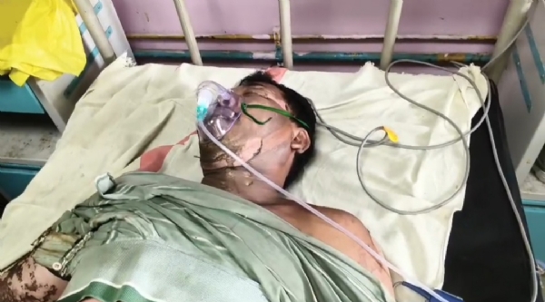 বিদ্যুৎস্পৃষ্ট হয়ে গুরুতর আহত নিগমকর্মী