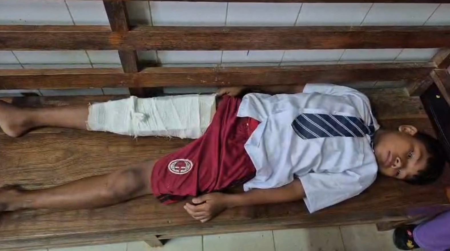 উল্টে গেল টমটম, আহত ৭ স্কুল পড়ুয়া 
